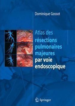 Télécharger le livre :  Atlas des résections pulmonaires majeures par voie endoscopique