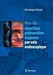 Télécharger le livre :  Atlas des résections pulmonaires majeures par voie endoscopique