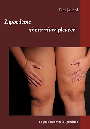 Téléchargez le livre :  Lipoedème aimer vivre pleurer