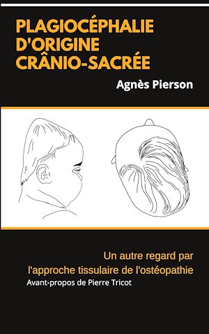 Téléchargez le livre :  plagiocéphalie d'origine crânio-sacrée