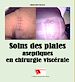 Télécharger le livre :  Soins des plaies aseptiques en chirurgie viscérale
