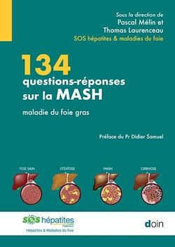 Télécharger le livre :  134 questions-réponses sur la MASH