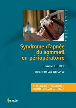 Télécharger le livre :  Syndrome d'apnée du sommeil en périopératoire