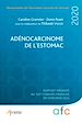Télécharger le livre :  Adénocarcinome de l'estomac