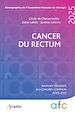 Télécharger le livre :  Cancer du rectum