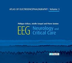 Télécharger le livre :  Atlas of Electroencephalography : Neurology and critical care - Volume 3