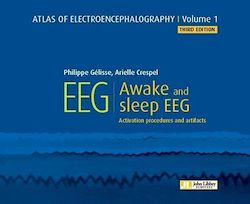 Télécharger le livre :  Atlas of electroencephalography - Volume 1 : Awake and sleep EEG. 3ED