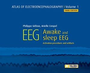 Download the eBook: Atlas of electroencephalography - Volume 1 : Awake and sleep EEG. 3ED