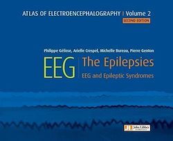 Télécharger le livre :  Atlas of electroencephalography Volume 2 : The Epilepsies. 2ED