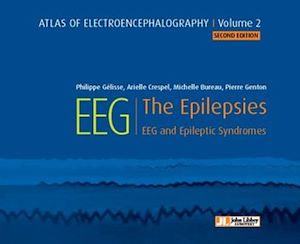 Download the eBook: Atlas of electroencephalography Volume 2 : The Epilepsies. 2ED