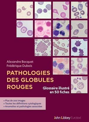 Download the eBook: Pathologies des globules rouges