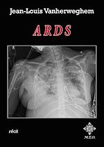 Télécharger le livre :  ARDS