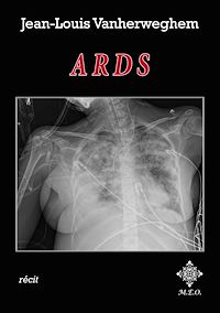 Télécharger le livre :  ARDS