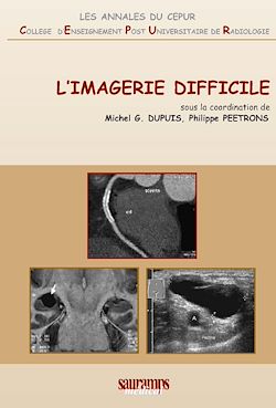 Télécharger le livre :  L'imagerie difficile