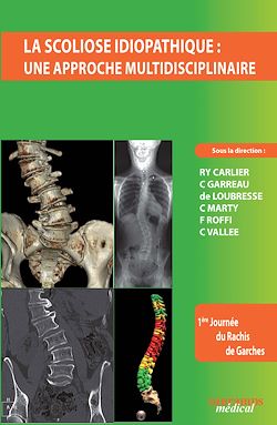 Télécharger le livre :  La scoliose idiopathique : une approche multidisciplinaire