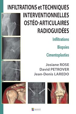 Télécharger le livre :  Infiltrations et techniques interventionnelles ostéo-articulaires radioguidées