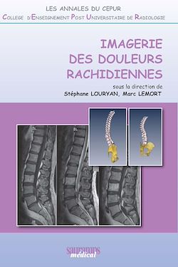 Télécharger le livre :  Imagerie des douleurs rachidiennes