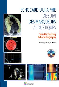 Télécharger le livre :  Echocardiographie de suivi des marqueurs acoustiques