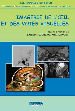 Télécharger le livre :  Imagerie de l'œil et des voies visuelles