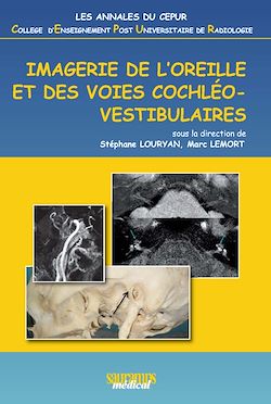 Télécharger le livre :  Imagerie de l'oreille et des voies cochléovestibulaires