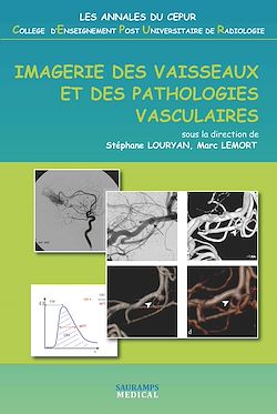 Télécharger le livre :  Imagerie des vaisseaux et des pathologies vasculaires