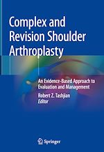 Télécharger le livre :  Complex and Revision Shoulder Arthroplasty