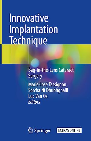 Téléchargez le livre :  Innovative Implantation Technique
