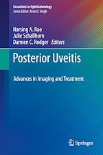 Télécharger le livre :  Posterior Uveitis