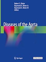 Télécharger le livre :  Diseases of the Aorta