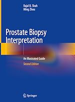 Télécharger le livre :  Prostate Biopsy Interpretation