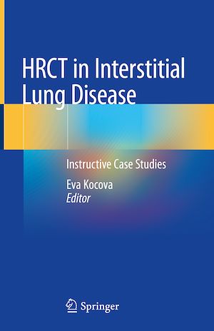 Télécharger le livre :  HRCT in Interstitial Lung Disease