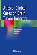 Télécharger le livre :  Atlas of Clinical Cases on Brain Tumor Imaging