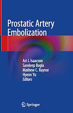 Télécharger le livre :  Prostatic Artery Embolization