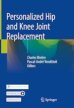 Download this eBook Personalized Hip and Knee Joint Replacement