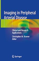 Télécharger le livre :  Imaging in Peripheral Arterial Disease
