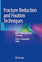 Télécharger le livre :  Fracture Reduction and Fixation Techniques