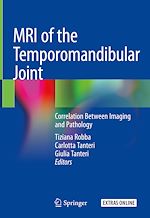Télécharger le livre :  MRI of the Temporomandibular Joint