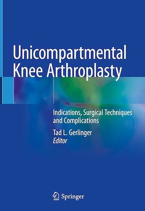 Téléchargez le livre :  Unicompartmental Knee Arthroplasty