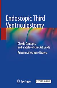 Télécharger le livre :  Endoscopic Third Ventriculostomy