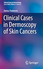 Télécharger le livre :  Clinical Cases in Dermoscopy of Skin Cancers