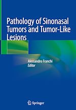 Télécharger le livre :  Pathology of Sinonasal Tumors and Tumor-Like Lesions