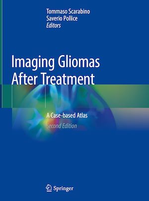 Téléchargez le livre :  Imaging Gliomas After Treatment
