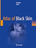 Télécharger le livre :  Atlas of Black Skin