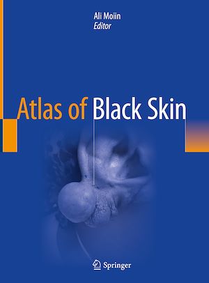 Téléchargez le livre :  Atlas of Black Skin