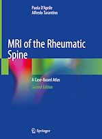 Télécharger le livre :  MRI of the Rheumatic Spine