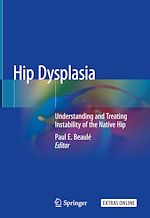 Télécharger le livre :  Hip Dysplasia