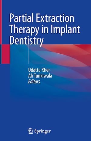 Téléchargez le livre :  Partial Extraction Therapy in Implant Dentistry