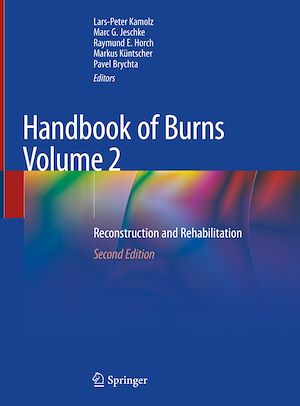 Download the eBook: Handbook of Burns Volume 2