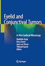 Télécharger le livre :  Eyelid and Conjunctival Tumors