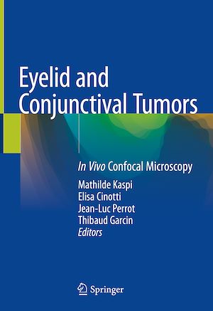 Téléchargez le livre :  Eyelid and Conjunctival Tumors